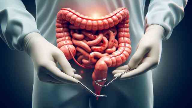 Colon Polyps Removal Singapore Is it Safe